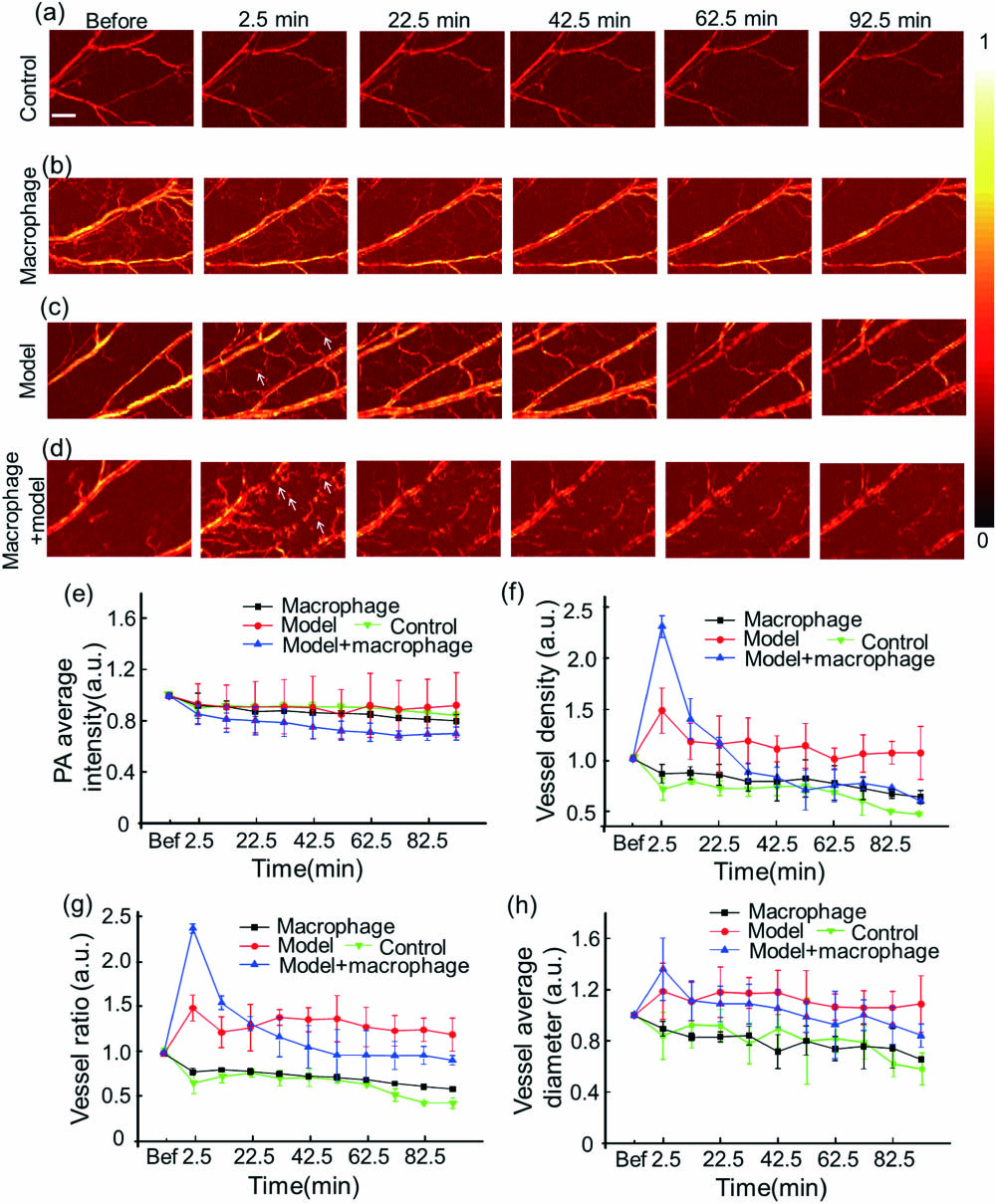 Monitoring the vessel using OR-PAM. PA images of the (a) control group without modeling and macrophages, (b) normal mouse ear group injected with labeled macrophages, (c) modeled mouse ear group, and (d) modeled mouse ear group injected with labeled macrophages. (e) PA average intensity, (f) vessel density, (g) vessel ratio (the area of vessels signal/the area of the whole imaging), and (h) vessel average diameter of four groups. The white arrows point to the new vessels caused by inflammation, while the blue arrows represent labeled macrophages. The scale bar is 500 μm.