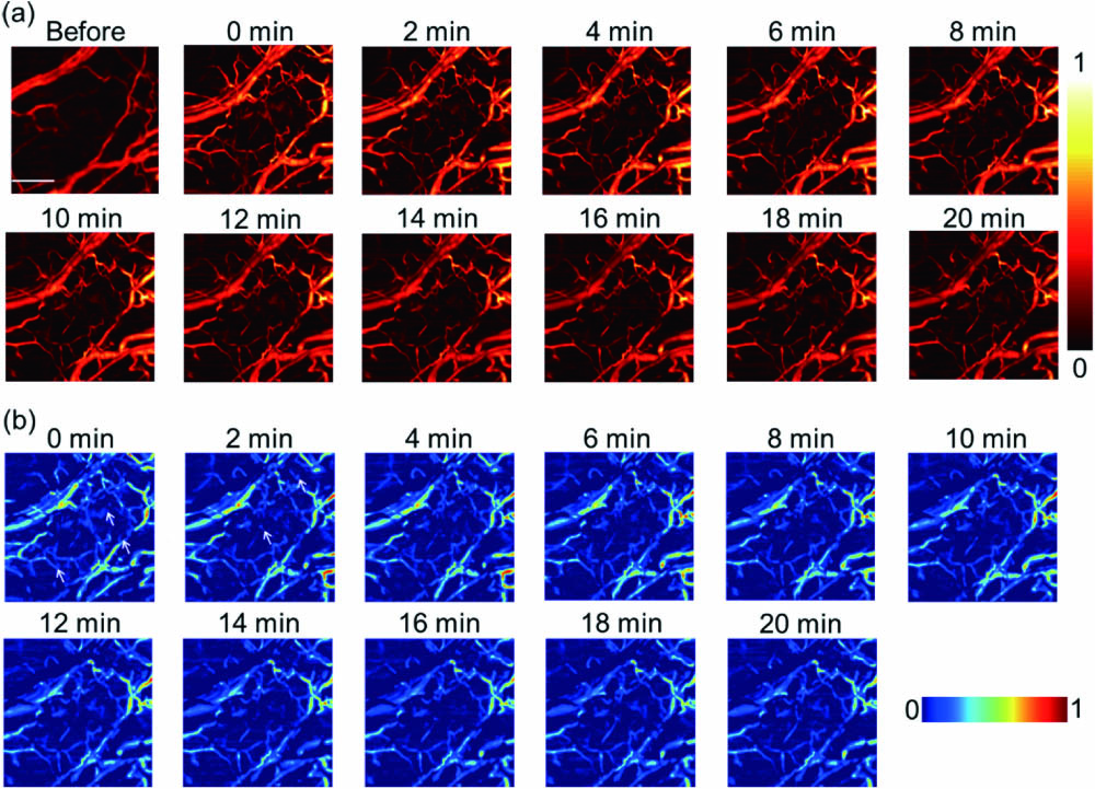 Monitoring the vessel changes by MEMS-OR-PAM through 20 min. (a) PA images of the modeled mouse ear group injected with macrophages in 20 min. (b) The images were obtained by subtracting the ear before modeling from the modeled ear injected with macrophages. The arrows represent the dispersion labeled macrophages. The scale bar is 500 μm.