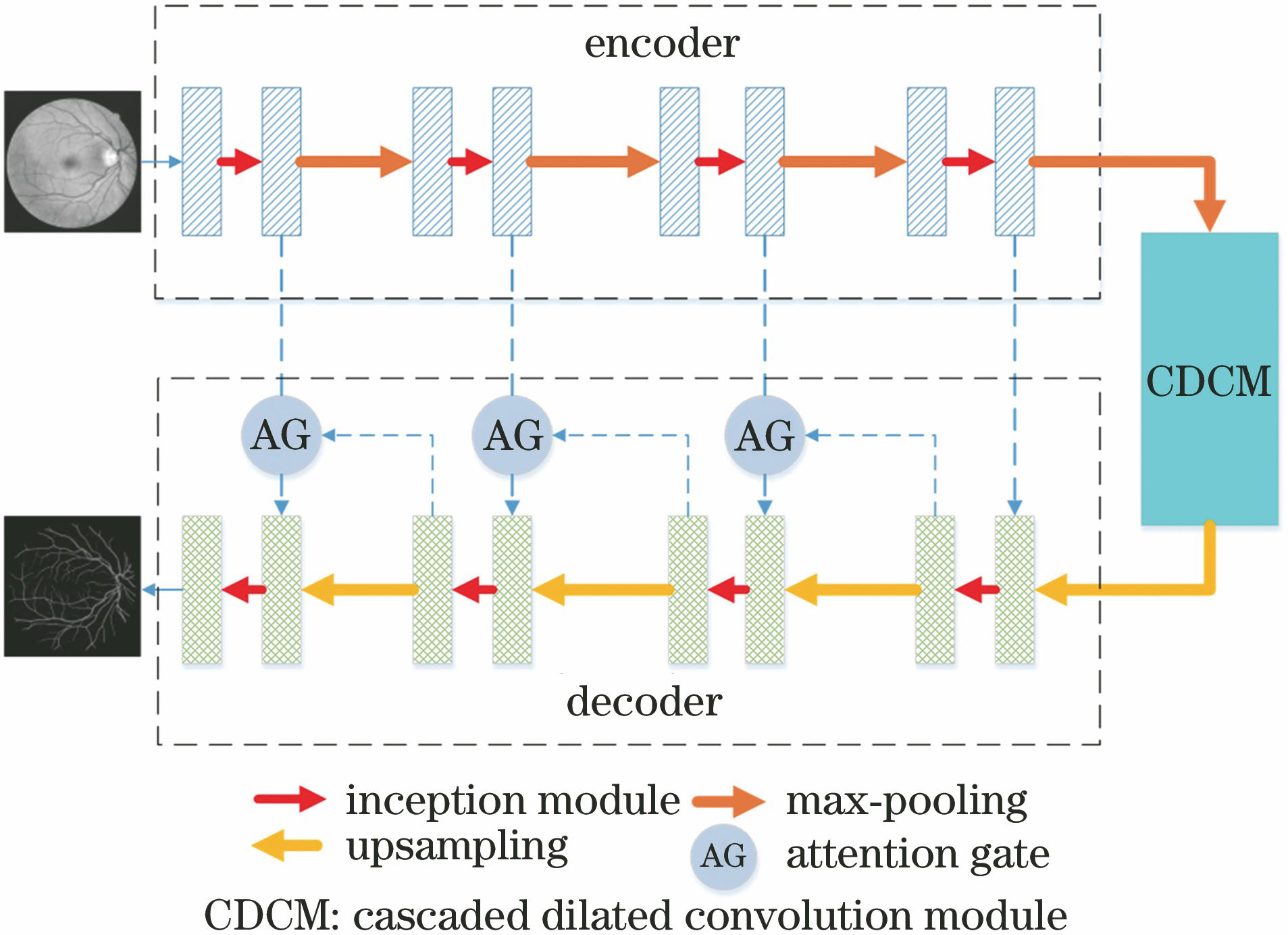 基于改进U-Net视网膜血管图像分割算法