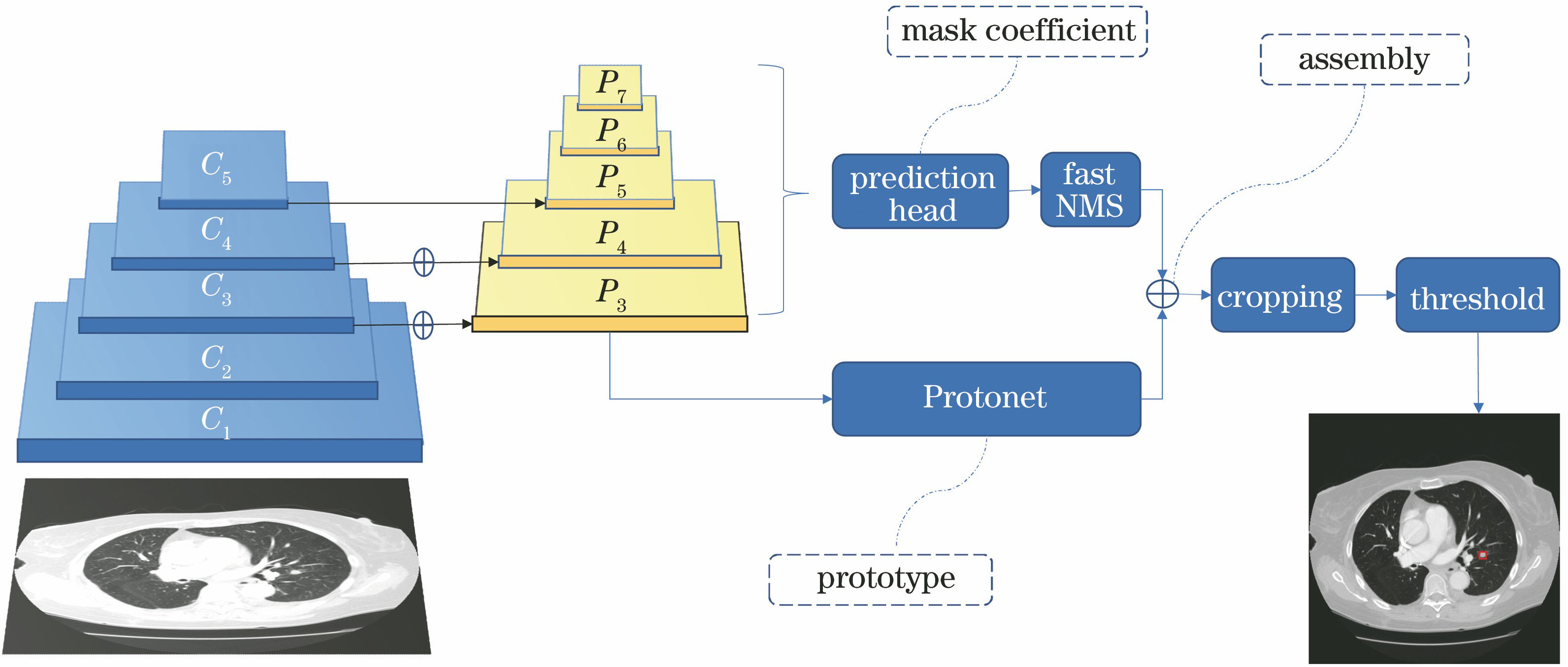 基于改进全卷积网络模型的肺结节检测