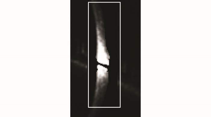 自适应阈值分割