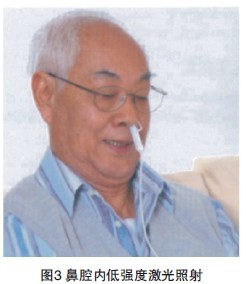 激光针刺与生物节律