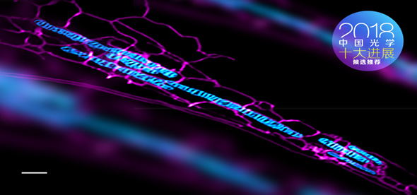 ѧŶ:ɭⳬ߷ֱ΢