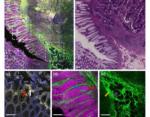 预啁啾和增益双管理的掺yb光纤激光器实现slam医学成像
