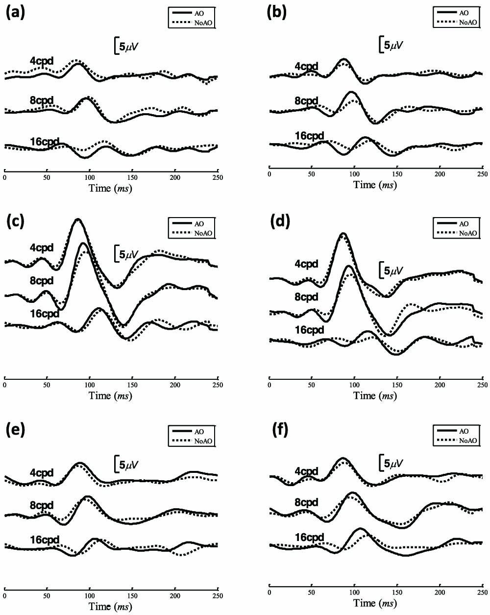 PR-VEP waveform comparison of three subjects without and with AO correction. (a) and (b) are the right and left eye of DP, respectively. (c), (d) and (e), (f) correspond to ZZ and CKY, respectively.