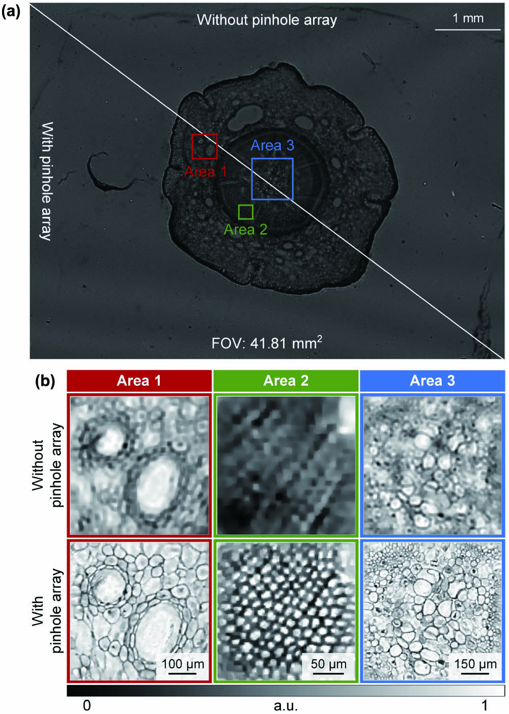 Experimental result of pine stem. (a) The raw hologram captured at the red light without the pinhole array and with the pinhole array. (b) The amplitude distributions reconstructed by multi-wavelength phase retrieval corresponding to Area 1, Area 2, and Area 3 without the pinhole array and with the pinhole array.