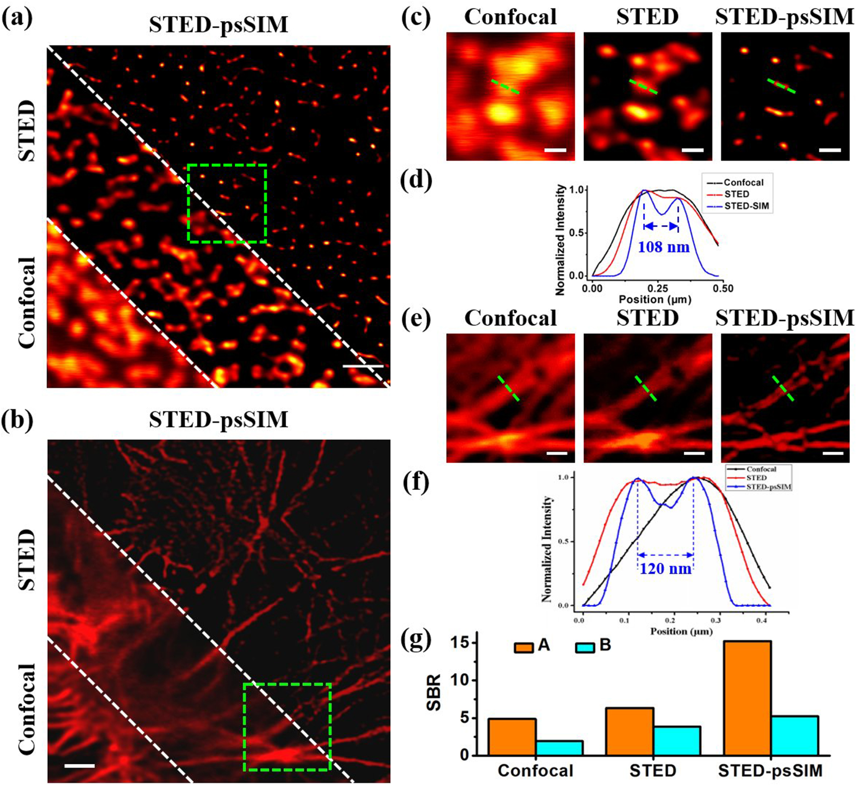 Resolution improvement in STED-psSIM for biological imaging. (a) Images of NPC and (b) labeled actin in huFIB cells captured by confocal microscope (lower left), STED (middle), and STED-SIM (upper right) separated by two dashed green lines; (c) and (e) magnified view of the area encircled by the dashed box in (a) and (b); (d) and (f) normalized intensity profiles along the green dashed lines in (c) and (e), respectively; (g) SBR of the two biological samples in the three methods. Scale bars, 1 µm in (a), (b), 0.4 µm in (c), and 0.2 µm in (e).