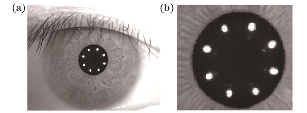 采集的人眼图像与ROI图像。(a)人眼原图像;(b)瞳孔ROI图像