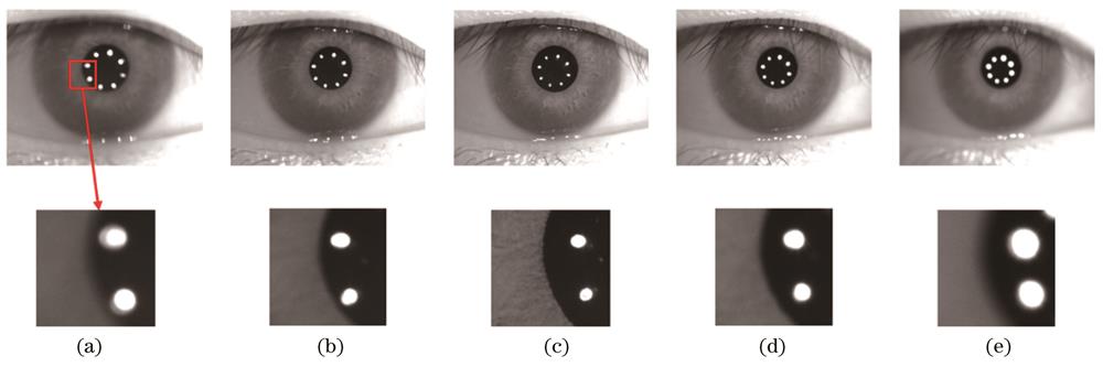 人眼离焦序列1示意图。(a)序列第5张图像;(b)序列第9张图像;(c)序列第13张图像;(d)序列第17张图像;(e)序列第21张图像