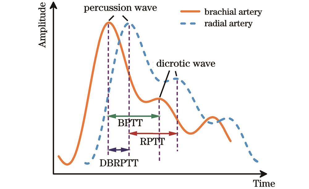 肱动脉和桡动脉的典型脉搏波形