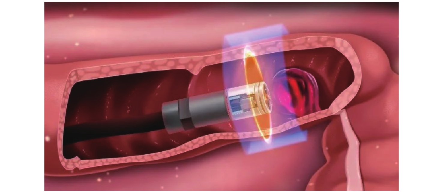 Schematic diagram of a fiber optic endoscope Schematic diagram of a fiber optic endoscope