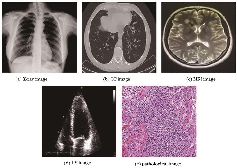 相似象学会誌　相似象　第六号 PDF) In vitro-in vivo correlation study on nimesulide loaded