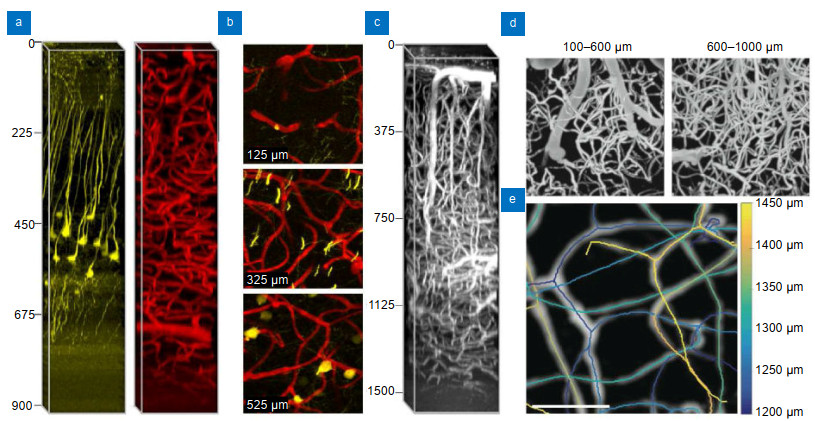 Recent advances in nonlinear optics for bio-imaging