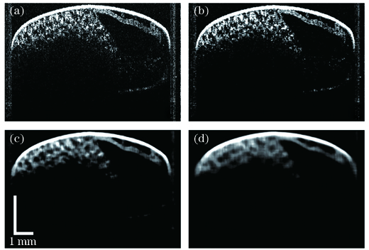 选择不同邻域范围进行中值滤波后的图像。(a)原始OCT图像;(b)邻域范围3×3;(c)邻域范围11×11;(d)邻域范围19×19