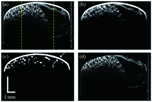 昆虫胚胎影像的处理过程。(a)原始OCT图像;(b)滤波;(c)局部阈值分割(S,卵壳);(d)卵壳图像消除