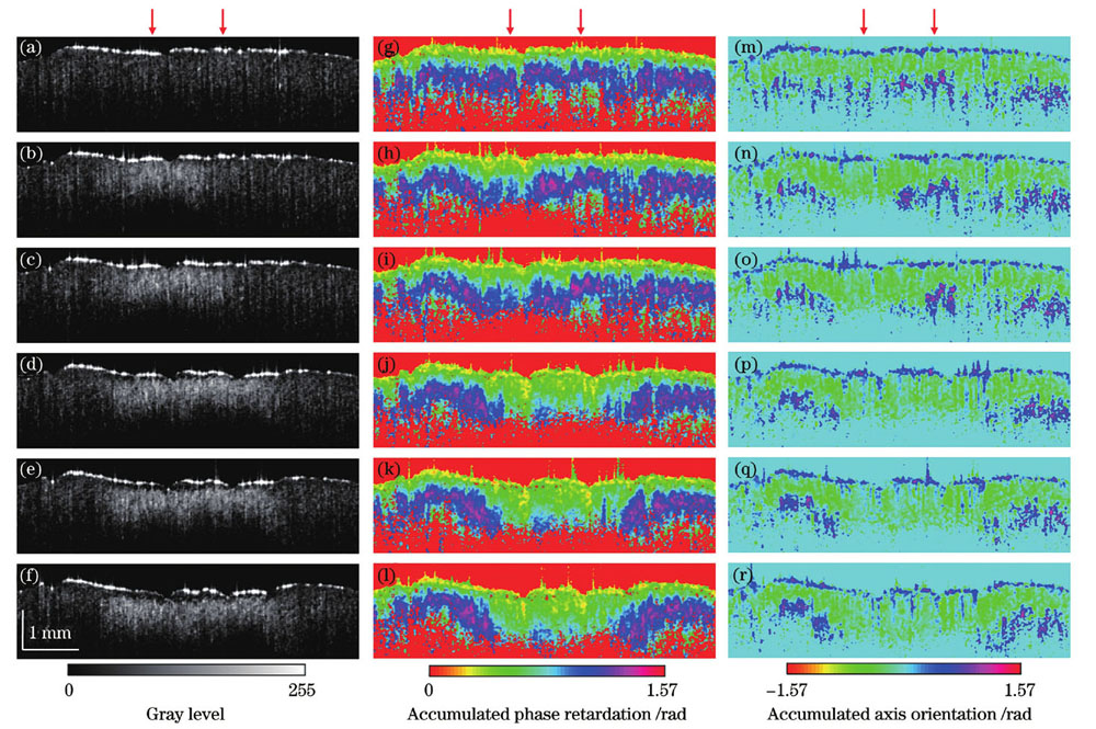 未灼烧以及累积灼烧10、20、30、40、50 s牛腱组织的PSOCT图像重建结果。(a)~(f)OCT强度图像;(g)~(l)累积相位延迟层析图像;(m)~(r)累积光轴方位角层析图像