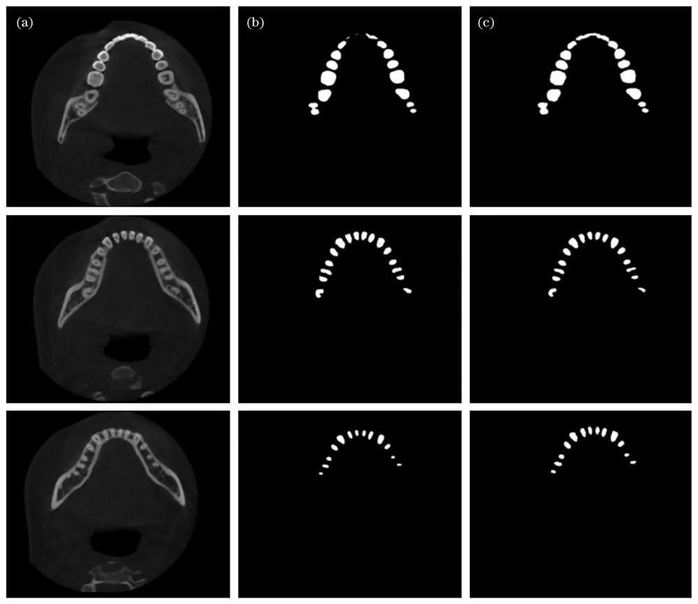 U-net模型识别效果。(a)待识别图像;(b)原始U-net方法识别效果;(c)改进U-net方法识别效果