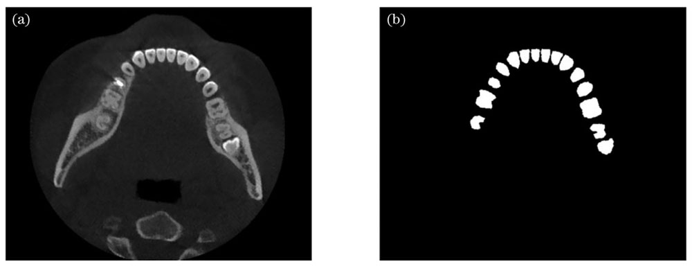 带有牙齿填充物的图像识别效果。(a)待识别图像;(b)改进U-net方法识别效果