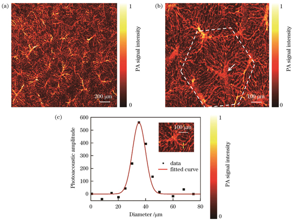 正常肝脏微血管结构的光声显微成像与直径分析。(a)正常肝组织肝小叶的光声图像;(b)中央静脉和肝血窦;(c)肝血窦直径的定量分析
