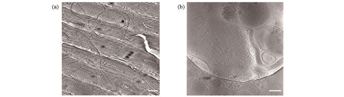 冷冻固定在非晶冰中的生物样品(标尺:200 nm)。(a)利用高压冷冻固定的U2OS细胞超薄切片的透射电镜图像;(b)利用快速冷冻固定的PC12细胞的透射电镜图像