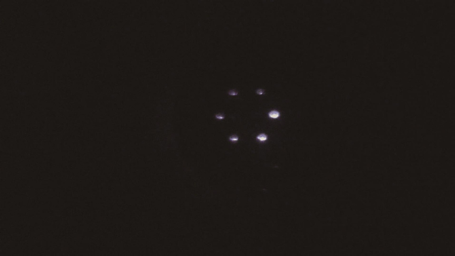 角膜曲率测量结果