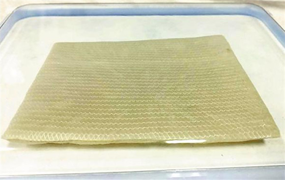 烧伤病人或无需"割肉补疮":国产"人工真皮"进入临床试验