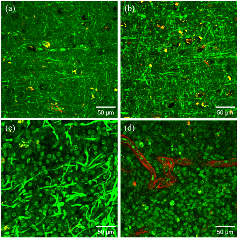 封面三次谐波显微成像精准识别肿瘤细胞