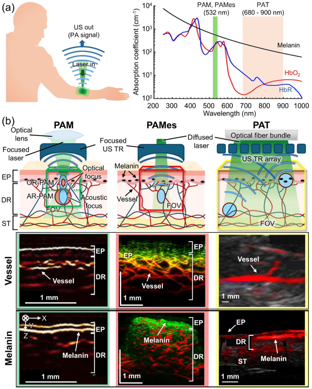 封面：用于活体表皮分析的多尺度光声成像技术| Advanced Imaging-中国激光杂志社